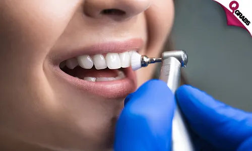 Composite Tooth Filling, Scaling, Polishing & More!